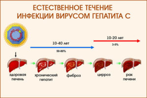 Гепатит С продолжительность 25 лет