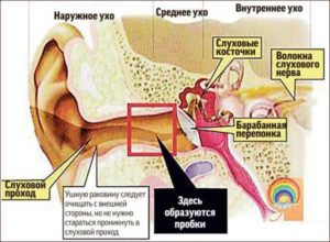 Головная боль, свист в ухе