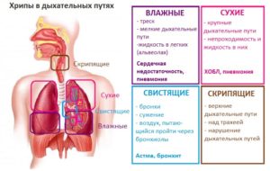 Хрипы в бронхах или легких