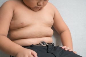 Ожирение и разный размер груди у мальчика