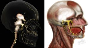 Нейропатия тройничного нерва и шейный хондроз
