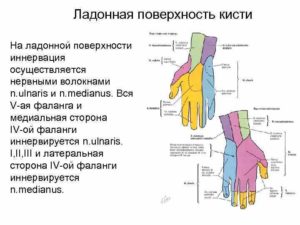 Гиперпараестезия 4 и 5 пальца левой кисти в районе иннервации n. Ulnaris