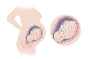 Низкое положение головки в 32-33 недели беременности