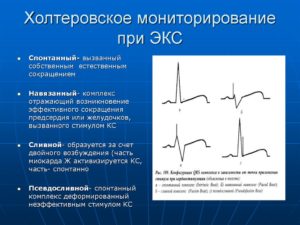 Холтер расшифровать онлайн