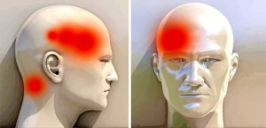 Головная боль в правом виске ухудшение зрения на правом глазу