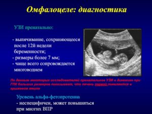 Омфалоцеле печени у плода, срок беременности 13 недель
