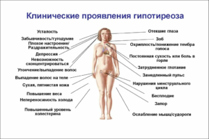 Озонотерапия при гипотиреозе?