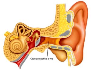 Не проходит средний отит