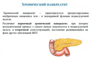 Геморой и хронический панкреатит