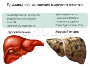 Горечь во рту при лечении панкреатита и жирового гепатоза