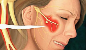 Онемение правой щеки и уха. Неприятные ощущения