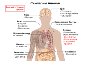 Низкий гемоглобин, слабость, головокружение