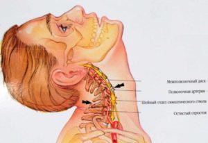 Головные боли, сдавливания шеи, тяжело дышать