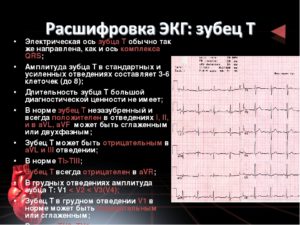 Неопределенная фронтальная ось QRS на экг