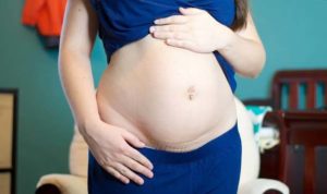 Гормональный сбой или беременность, 5 месяцев после кесарево