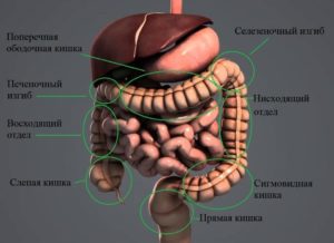 Образование ободочной кишки