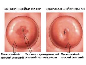 Не окрашивается Шейка матки