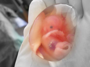 Не вышло околоплодное яйцо при медикаментозном аборте