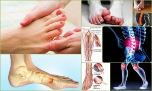Онемение пальцев ноги