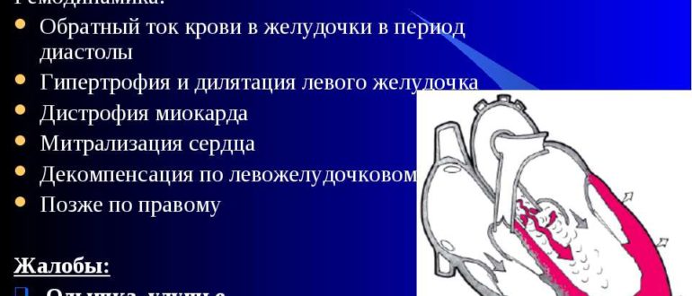 Недостаточность аортального клапана - насколько это страшно?