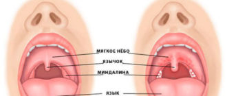 Горло красное и сопли текут