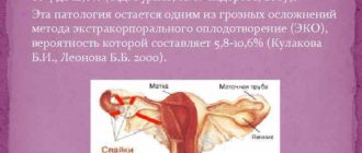 Не проходящие боли после тубэктомии