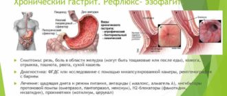 Горечь во рту, диагноз рефлюкс эзофагит
