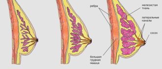 Одна грудь болит сильнее, чем другая