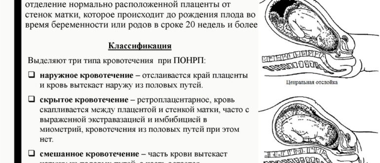 Отслойка нормально расположенной плаценты, хочу разобраться в причине