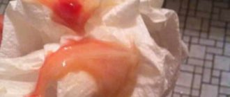 Отхождение пробки на 40 неделе беременности