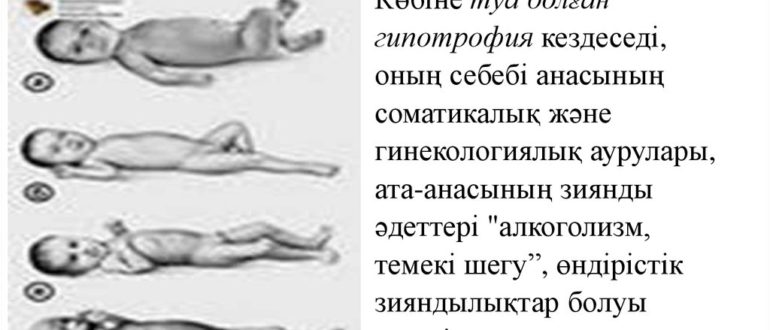 Гипотрофия матки