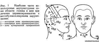 Онемение левой части головы