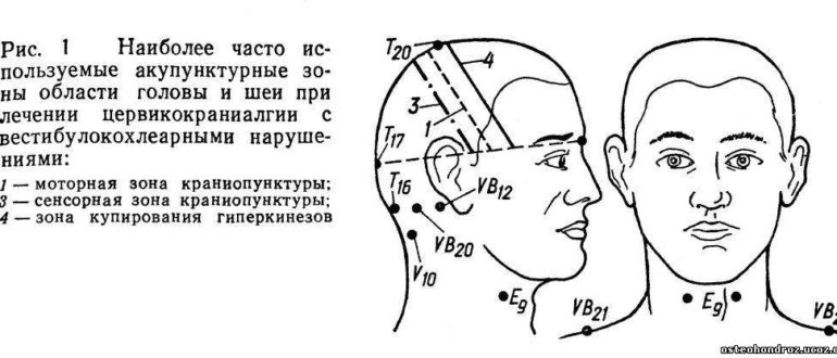 Онемение левой части головы