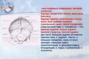 Определяется некоторая продавленность борозды поперечного синуса