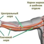 Физические нагрузки, спорт после карциномы щитовидной железы