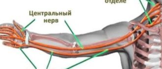 Немеет правая рука