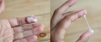 Нехарактерные выделения