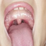 Грязные перчатки у гинеколога на приёме чем грозят