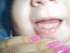 Нет зубов в 11 месяцев