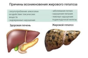 Горечь во рту при лечении панкреатита и жирового гепатоза