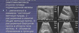 Объемное образование поджелудочной железы