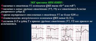 Особенности проведения по правой НПГ