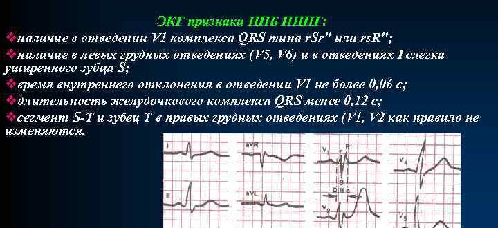 Особенности проведения по правой НПГ