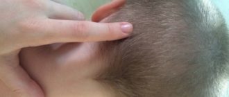 Небольшая шишечка на голове у ребенка