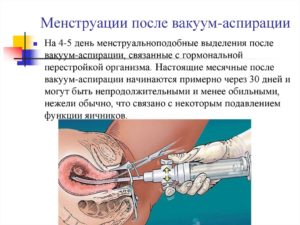 Нет выделений после вакуумного аборта