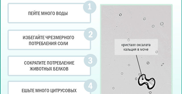 Оксалаты в моче при беременности