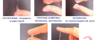 Нормально ли после принятия микасиста выделения