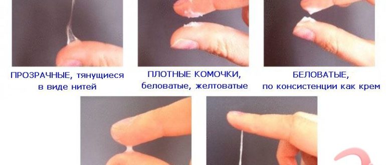 Нормально ли после принятия микасиста выделения