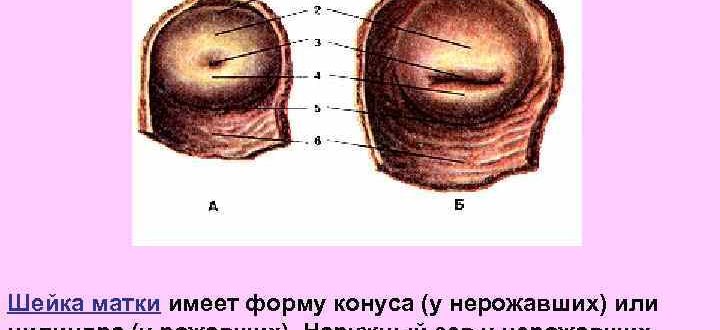 Форма зева шейки матки