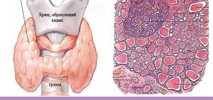 Объемные образования паренхимы щитовидной железы